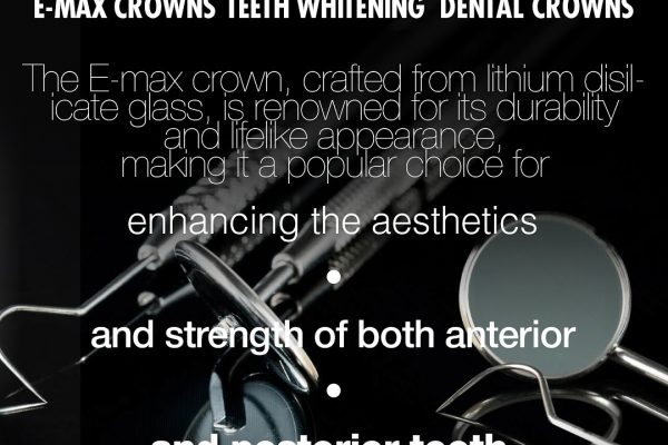How Long Do Dental Implants Last? The Best Guide
