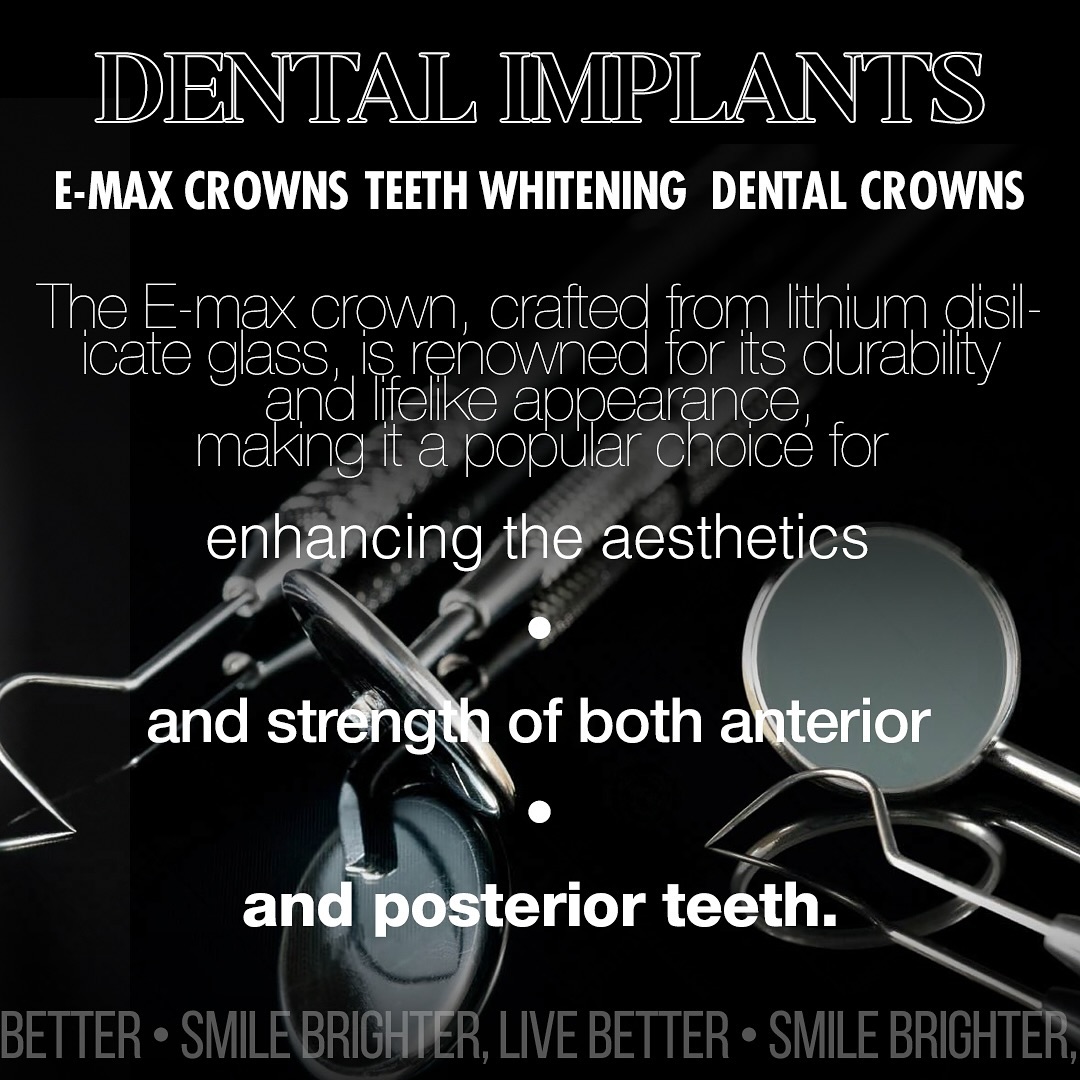 dental implants