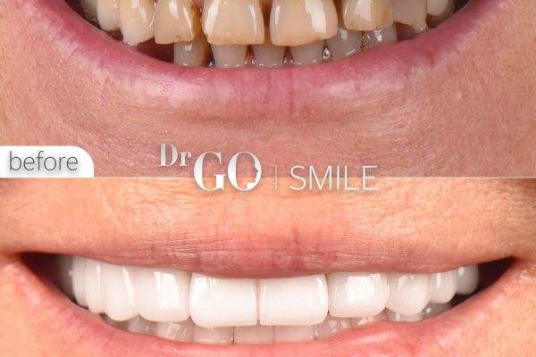 Poor Dental Hygiene and Overall Health: Interesting Facts