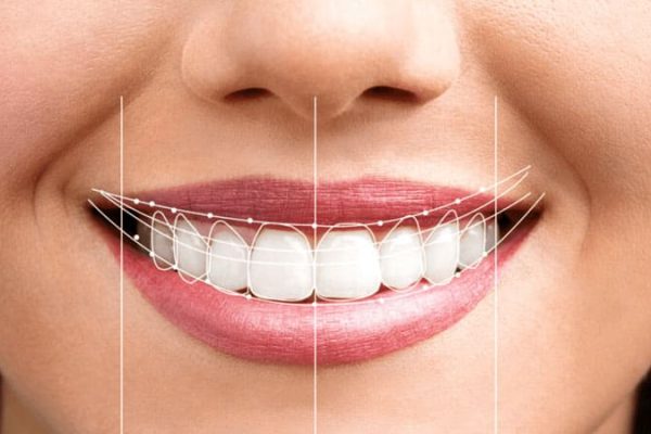 Rediscover Your Smile with Gum Aesthetics