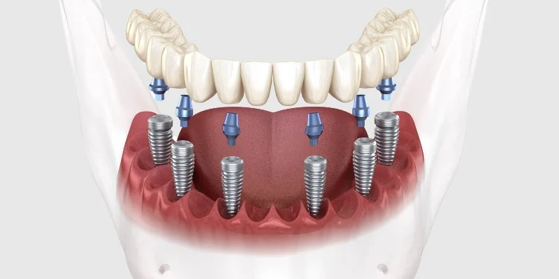 all on six in Turkey