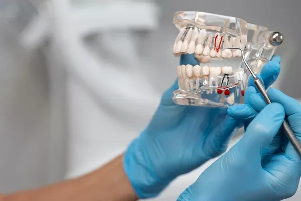 Implantology at Dr. GO Smile: The Future of Tooth Replacement with Dental Implants