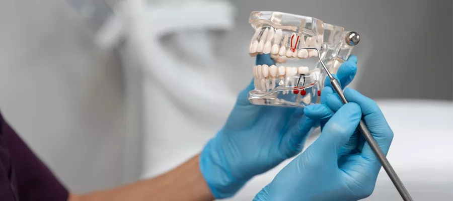 Implantology at Dr. GO Smile: The Future of Tooth Replacement with Dental Implants