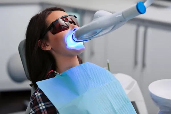 Teeth Whitening Treatments: At-Home or In-Clinic?