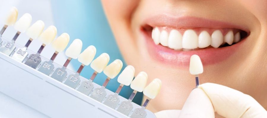 Dental Aesthetics in Turkey