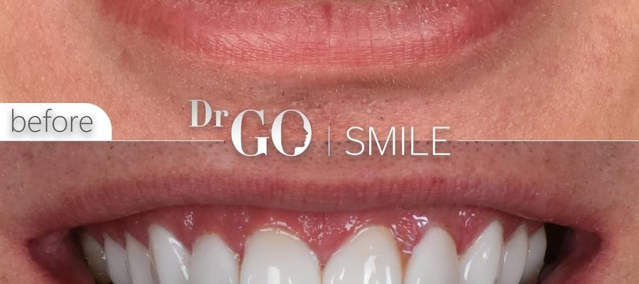 dental treatment in turkey vs usa