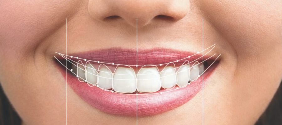 Perfect smile design in Istanbul