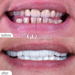 Hollywood Smile Istanbul