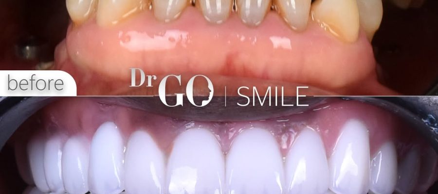 Dental Treatment Costs in Turkey for 2025