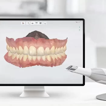 3d digital smile design in Turkey