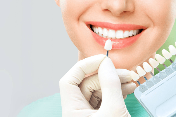 veneer care