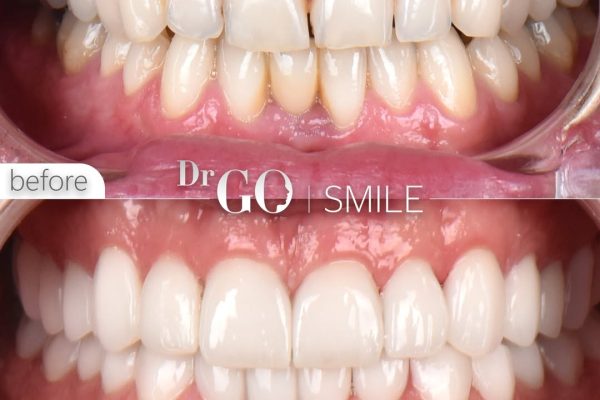 Why Turkey Is the Top Destination for Cosmetic Dentistry in 2026