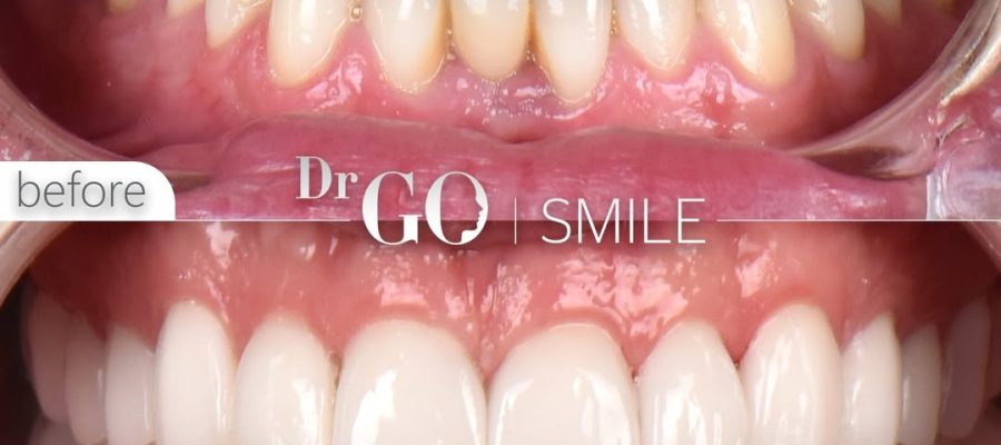 cosmetic dentistry