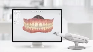 3D Digital Smile Design