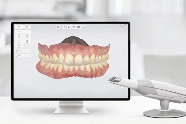3D Digital Smile Design with AI: See Your Future Smile Before Treatment Begins