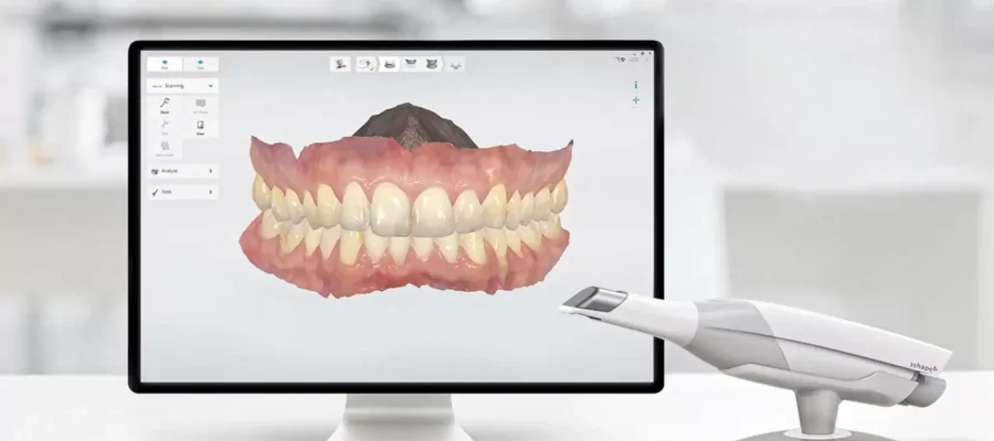 3D Digital Smile Design