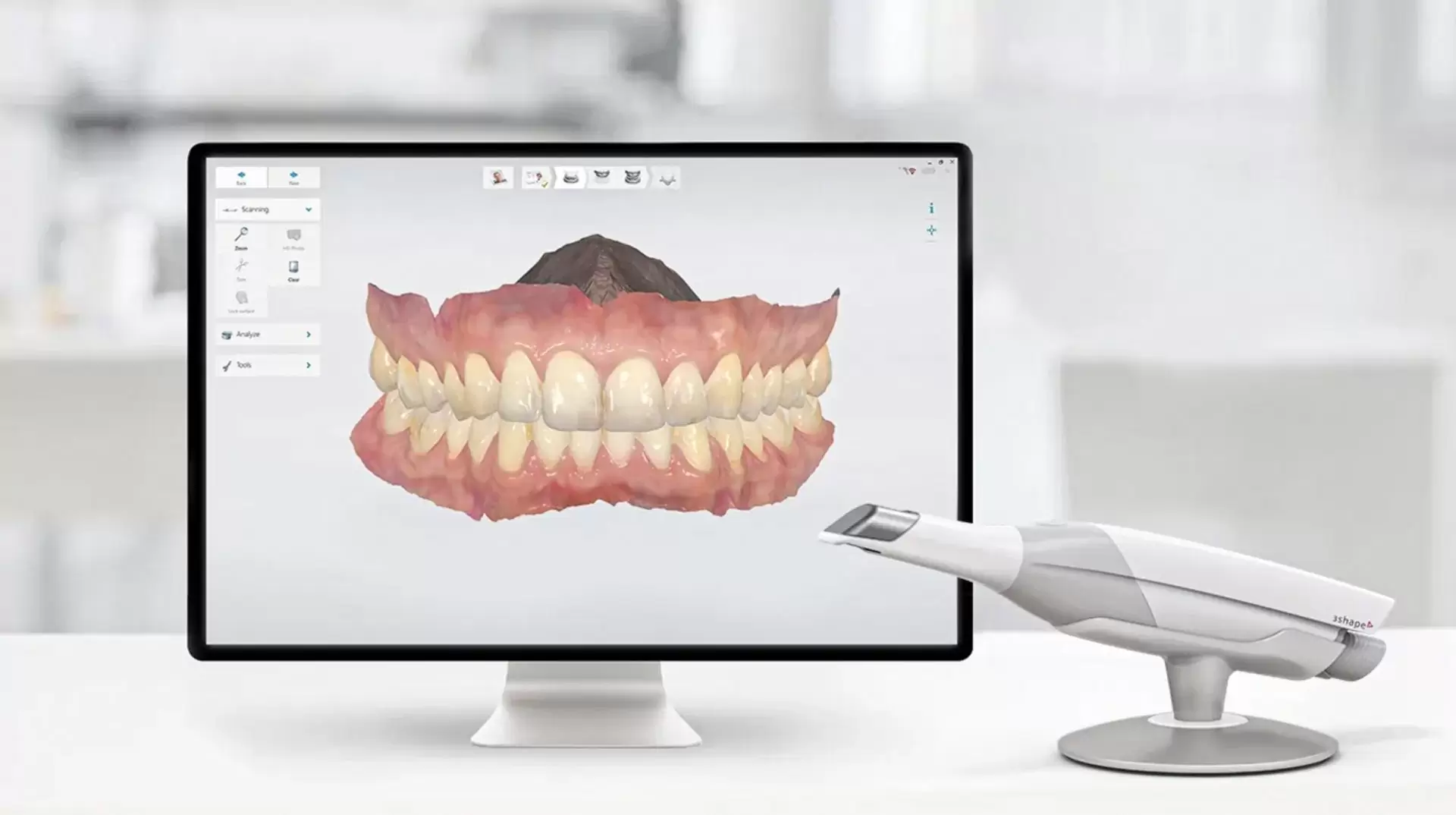 3D Digital Smile Design