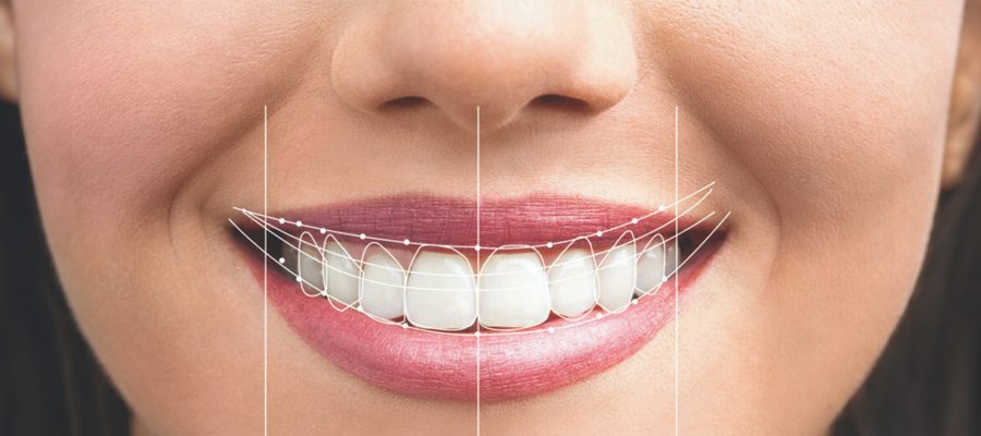 What Is Smile Design? Personalized Aesthetic Solutions at DRGO Smile