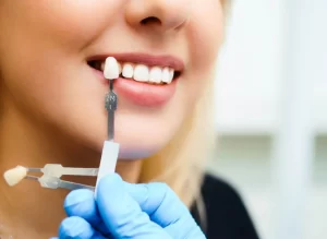the best dental clinic for smile makeover in Istanbul