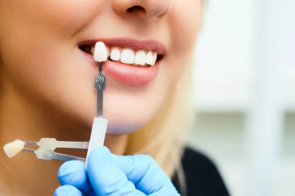 How to Choose the Best Dental Clinic for Smile Makeover in Istanbul