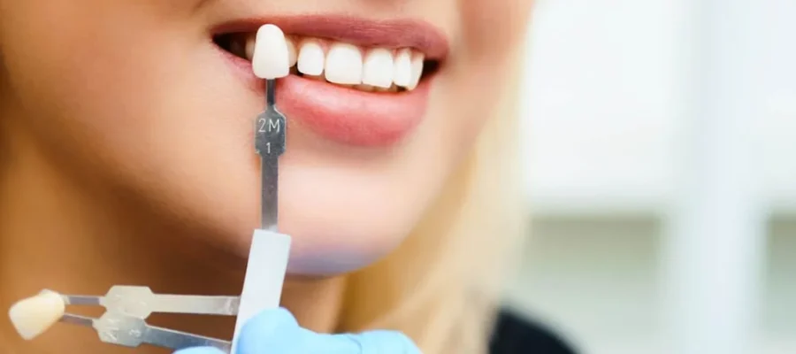 the best dental clinic for smile makeover in Istanbul