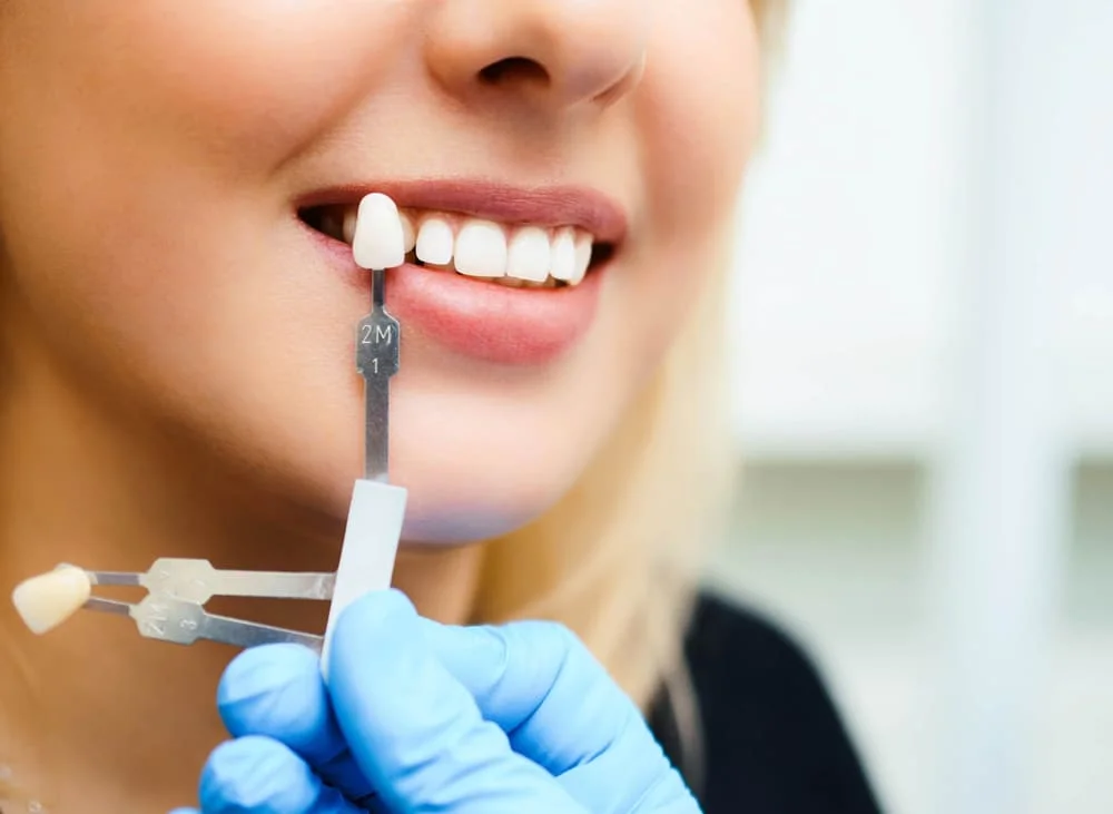 the best dental clinic for smile makeover in Istanbul
