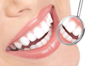 smile makeover