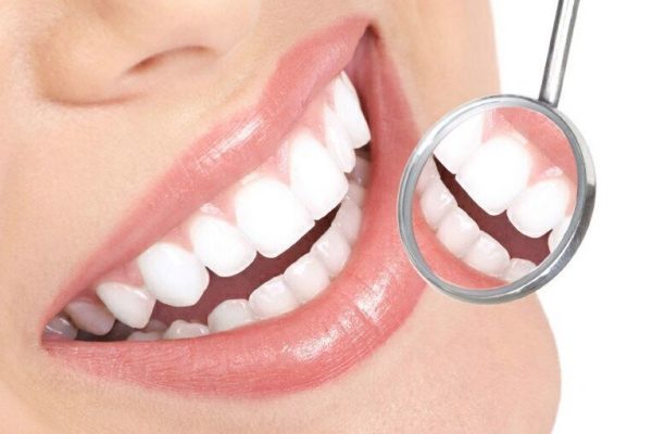 Designing Your Perfect Smile: A Guide to Full Smile Makeover