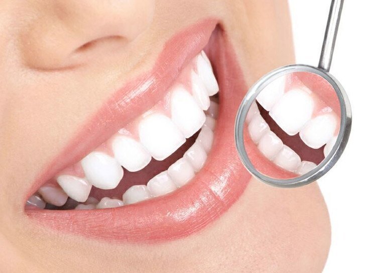 smile makeover