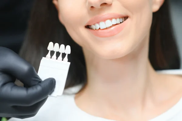 The Art of the Hollywood Smile: A Complete Guide to Your Transformation