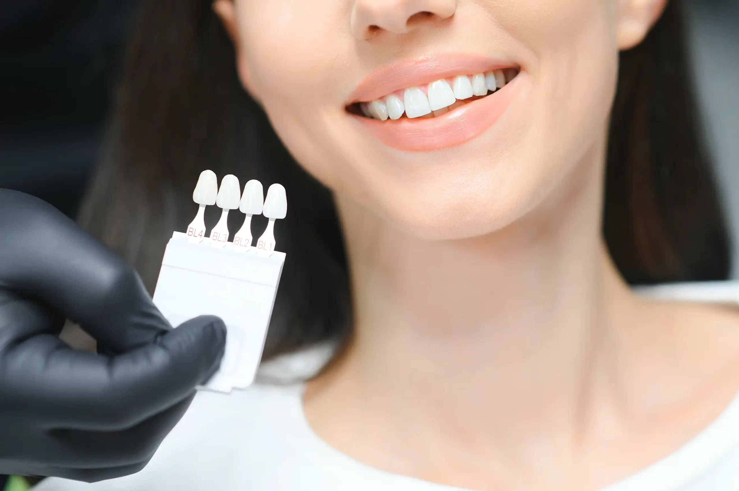 Hollywood Smile