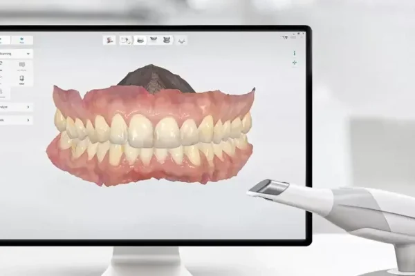 Digital Smile Design