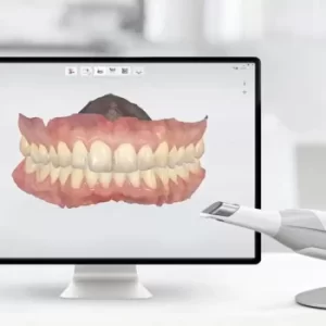 hollywood smile