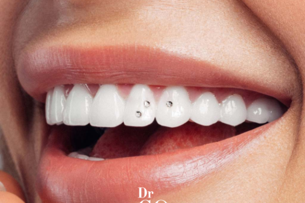 How to Get Whiter Teeth with Dental Crystals?