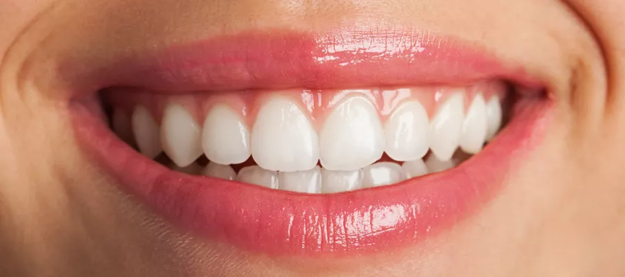E-max Crowns in Turkey: Discover the Benefits and Elevate Your Smile