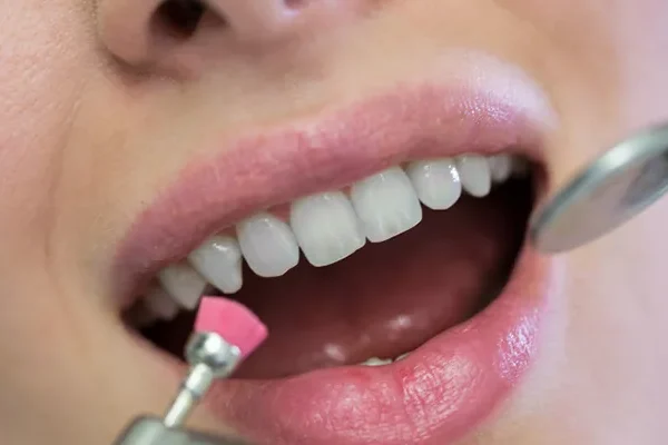 Gingival Treatments