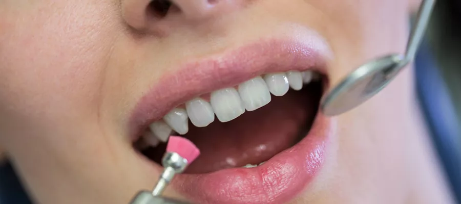 Gingival Treatments at Dr. GO Smile: Improve Your Smile with Expert Care