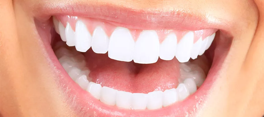 Exclusive Hollywood Smile in Turkey: Sculpting & Perfecting Your Smile