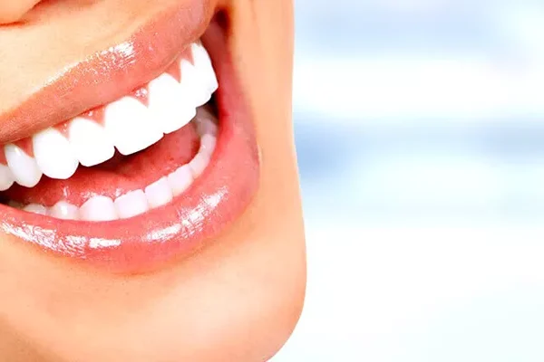 Digital Smile Design at Dr. GO Smile Dental Clinic in Turkey