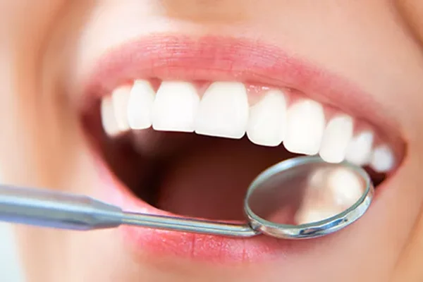 Teeth Whitening in Turkey: Achieving The Perfect Shade & Getting A Brighter Smile